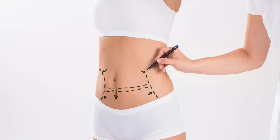 Chirurgie esthétique abdominoplastie Tunisie prix