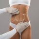 Chirurgie esthétique abdominoplastie circulaire Tunisie tout compris