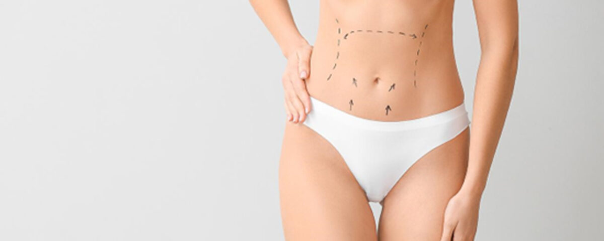 Prix chirurgie esthétique abdominoplastie avec liposuccion Tunisie