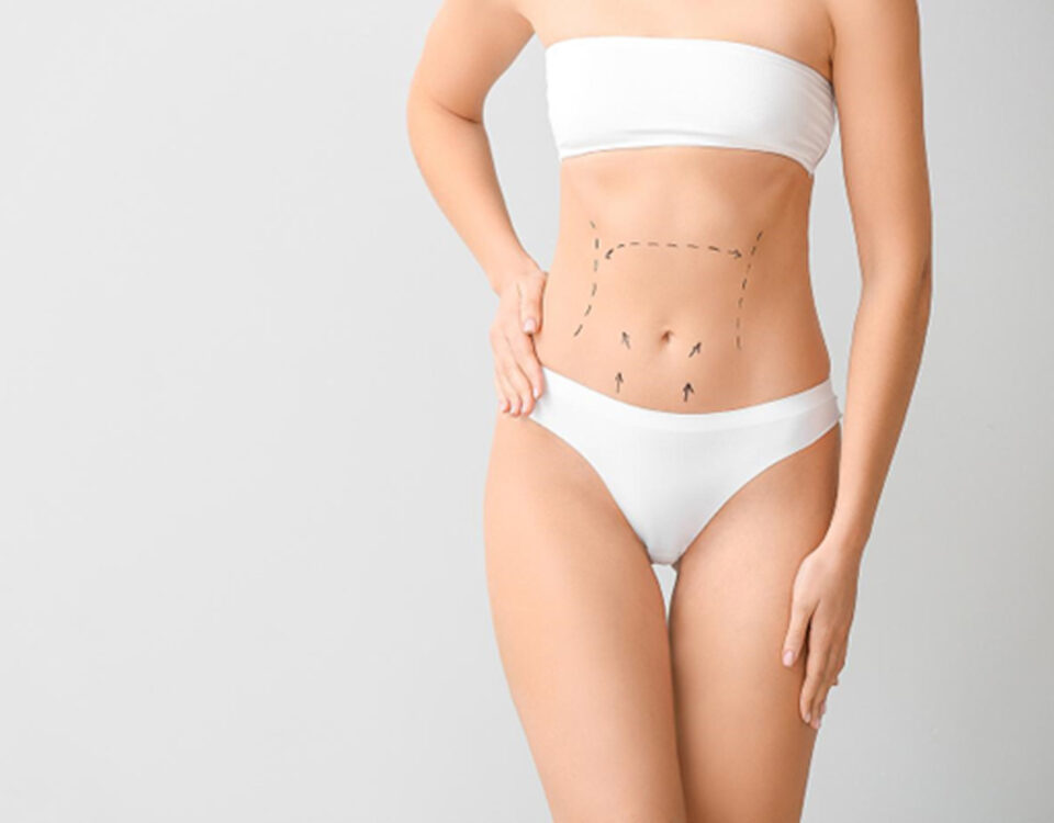 Prix chirurgie esthétique abdominoplastie avec liposuccion Tunisie