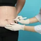 Combien de temps faut-il pour qu’une incision d’abdominoplastie guérisse ?